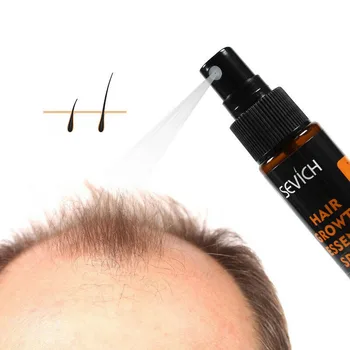 30ml Veiksminga Unisex Plaukų Augimo Esmė Purškimo Stabdžių Plaukų Slinkimas, Plaukų Remonto Auga Imbieras Atauga Esmė Plaukų Slinkimas Gydymo