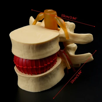 Anatominę Stuburo Juosmens Disko Herniation Anatomijos Mokymo Priemonė G6DD