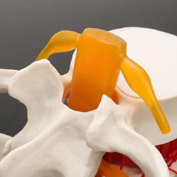 Skaidri Spalva Žmogaus anatomija skeletas Stuburo Juosmens Disko Herniation Mokymo Modelį mokyklinės prekės, medicinos instrume