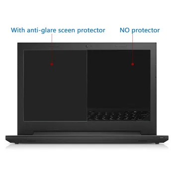 Universalus 15.6 colių Anti Akinimo Nešiojamas Screen Protector for Notebook Kraštinių Santykis 16:9 Matinis LCD Ekrano apsauga Plėvelės, 2vnt
