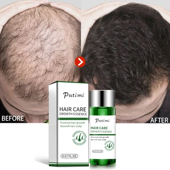 Veiksmingos Plaukų Augimo Serumas Išvengti Plaukų Slinkimas, Nuplikimas Produktų Auga Greičiau Plaukų Gydymo Esmė 20ml Vyrams ir Moterims