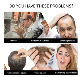 Veiksmingos Plaukų Augimo Serumas Išvengti Plaukų Slinkimas, Nuplikimas Produktų Auga Greičiau Plaukų Gydymo Esmė 20ml Vyrams ir Moterims