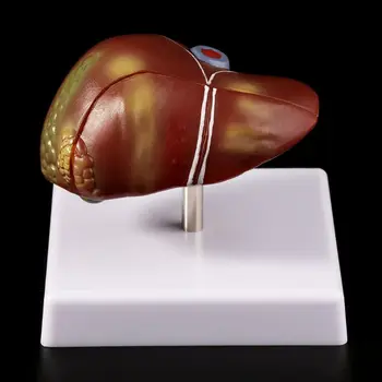 Žmogaus Kepenų Patologijos Anatomijos Modelis Anatomija Mokyklos Mokymo Rodyti Priemonė, laboratorijų Įranga L29K
